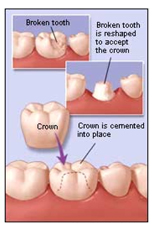 crown